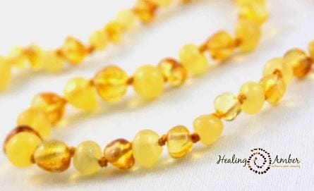 Healing Amber amber anklet Duo 11" - Healing Amber Baltic Amber Necklace Healing Amber Baltic Amber Necklace - Duo (Liquid Gold and Cream)