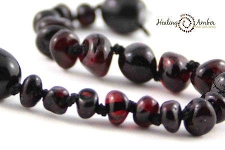 Healing Amber amber anklet 5-5.5 inch Healing Amber Baltic Amber Anklet/Bracelet - Molasses